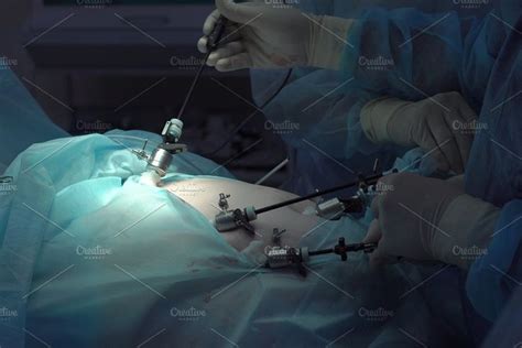 Operation Using Laparoscopic Equipment Surgeons Team Working With Of