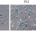 Characterization Of Bm Mscs Replicative Senescence A Representative