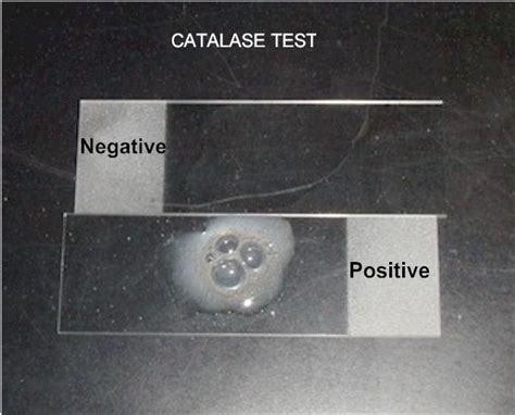 CATALASE TEST PROCEDURE - Microbiology Lab Notes