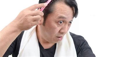 Hanya Pakai Bumbu Dapur Begini Cara Membuat Hair Mask Untuk Atasi