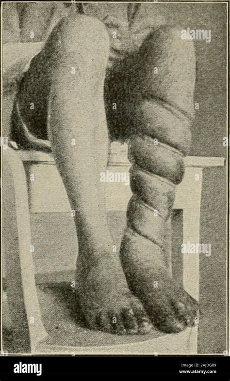 Plastic Surgery Its Principles And Practice Fig Fig Fig