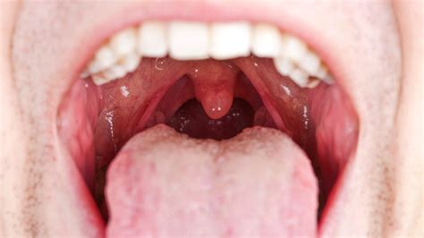 Saliva The Neglected Important Factor In Oral Health Ewan Bramley