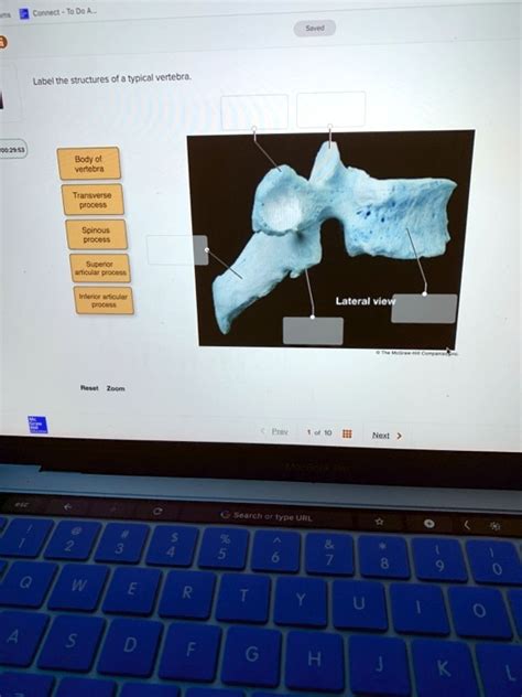 Solved Label The Structures Of A Typical Vertebra Body Of Vertebra