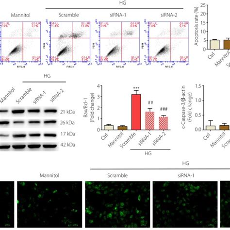 Silencing Of BASP1 Inhibits High Glucose Induced Apoptosis In HUVECs