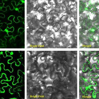 Subcellular Localization Of The GhTPR Protein In Tobacco Leaf Cells