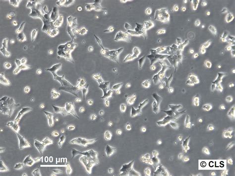 NCI H295R Cells