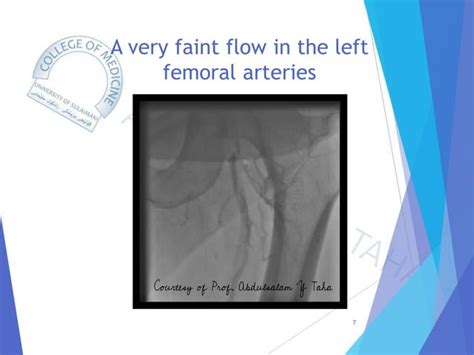 Suspected Aortofemoral Bypass Graft Thrombosis Pdf Free Download