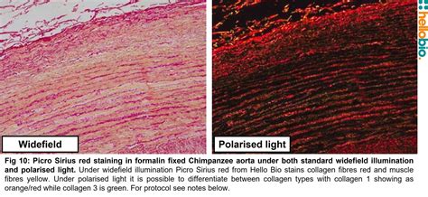 Picro Sirius Red Stain Kit Collagen Connective Tissue Stain Hello Bio