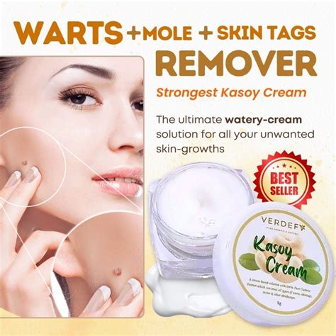 ORIGINAL STRONG KASOY CREAM EFFECTIVE REMOVER OF WARTS MOLE SKIN TAG