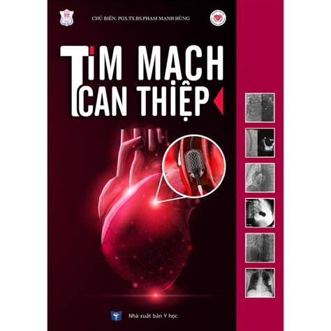 tim mach  thiep medup