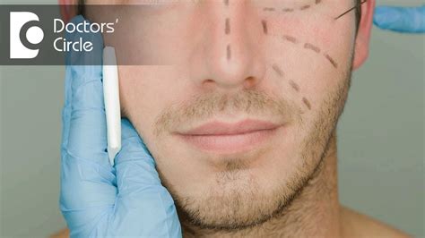 What Are The Most Popular Cosmetic Surgery Procedures For Men Dr