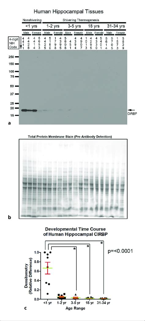 Developmental Time Course Of Cold Induced RNA Binding Protein CIRBP