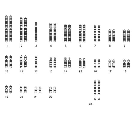 Analyzing A Karyotype To Identify Chromosomal Abnormalities Practice