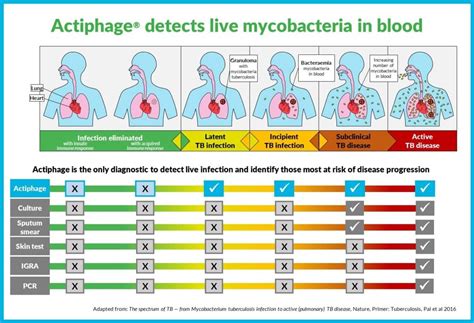 Role In TB Testing PBD Biotech