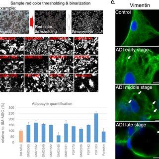 Ph Skp Cells Can Differentiate Into Smooth Muscle Cells And