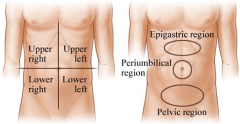 Acute Abdominal Pain Flashcards Quizlet