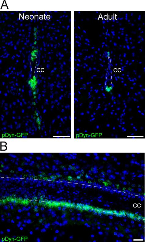 A Population Of Cerebrospinal Fluid Contacting Neurons Csf Cns Are