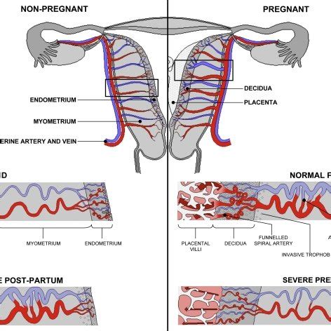 Diagrammatic Representation Of Uterine And Placental Vasculature Red