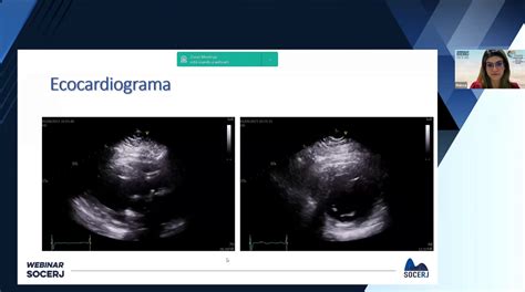 SOCERJ Ecocardiograma Makadu Live 2023