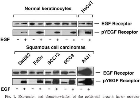 Figure 1 From Complex Regulation Of Signal Transducers And Activators