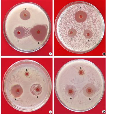 Phytochemical Evaluation And In Vitro Antibacterial Activity Of