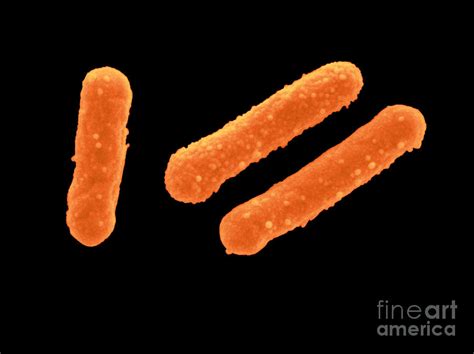 Escherichia Coli Photograph By Scimat