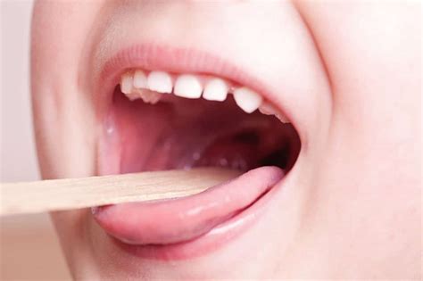 Pediatric Tonsil Infection Mid Valley Ent And Allergy