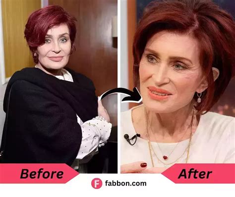 Sharon Osbourne Loses Pounds After Using Ozempic Her Weight Loss