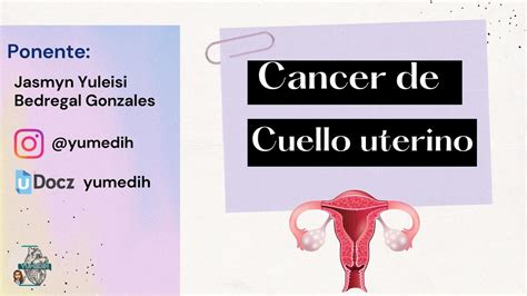 C Ncer De Cuello Uterino Yumedih Udocz