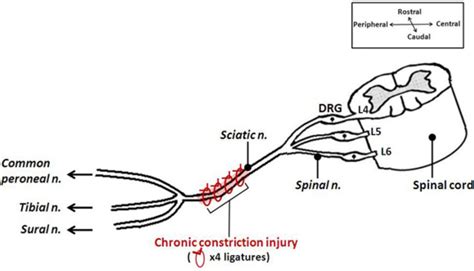 Chronic Constriction Injury Cci Model Creative Bioarray