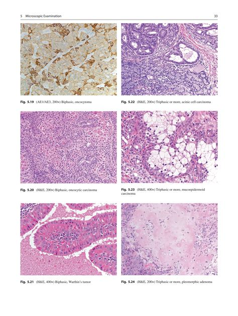 Atlas Of Salivary Gland Pathology PDF