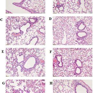 Histopathological Changes In Lung Tissues Histological Changes Were