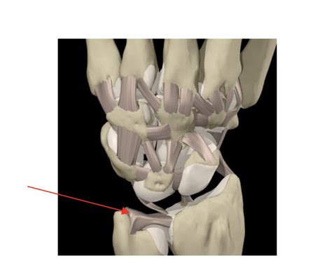 Traitement arthroscopique d une lésion centrale du ligament