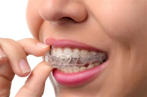 Invisalign Care 101 A Comprehensive Cleaning And Maintenance Guide