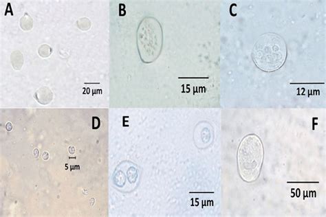 Different Types Of Protozoal Cysts And Oocysts Observed In Fresh Download Scientific Diagram