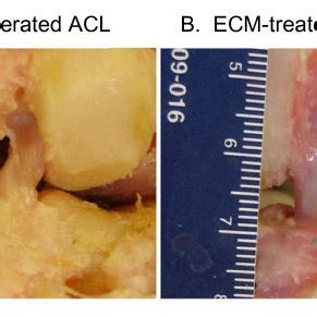 Gross Morphology Of A Sham Operated Acl And B Ecm Treated Healing