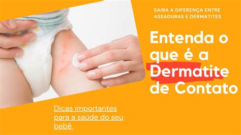 Diferença entre Assaduras e Dermatites de Contato Dipano Fraldas