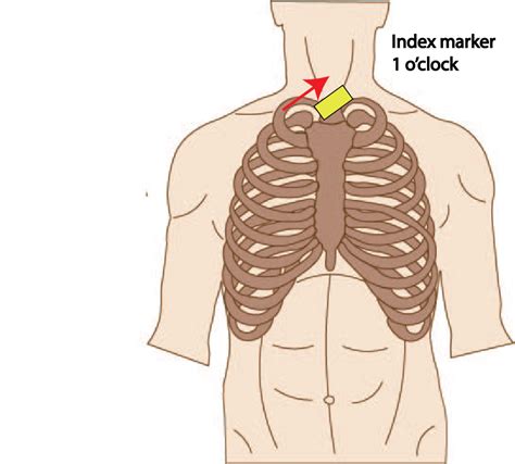 Discovering The Aorta Through Ultrasound Critical Care Sonography