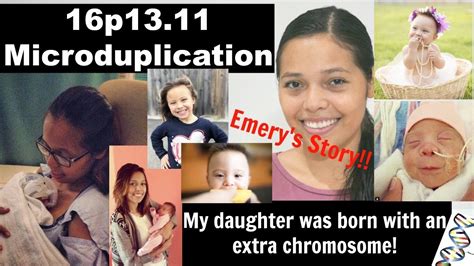 Testimony Tuesday My Daughter Was Born With An Extra Chromosome Youtube