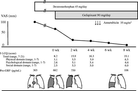 Efficacy Of Gefapixant A P2x3 Antagonist For Lung Cancer Related Cough A Case Report