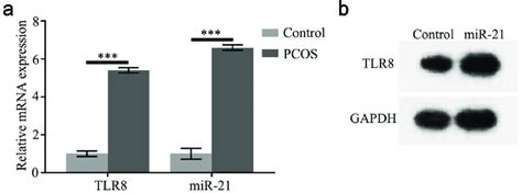 High Expression Of Tlr8 And Mir 21 In Pcos Ovarian Granulosa Cells A