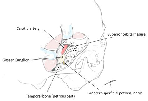 Anatomy Of Meckel S Cave Image Of Own Elaboration Inspired By Sun Et