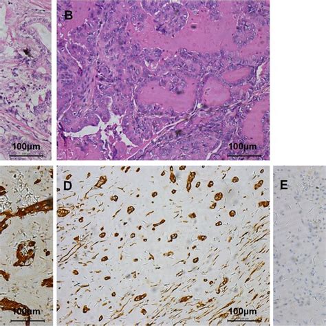 Histopathology Profiles A Haematoxylin And Eosin He Staining Of