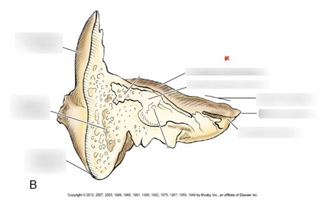 M1 Temporal Bone Coronal Cut Diagram Quizlet