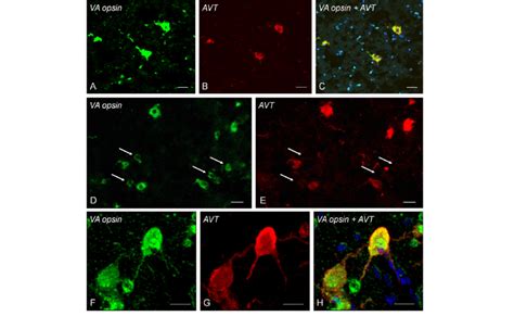 Confocal Images Of Double Immunolabeling Demonstrating Co Localization