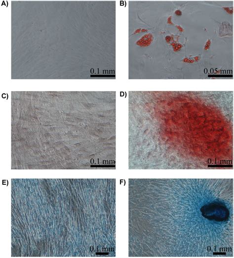 Staining For Adipogenic Osteogenic And Chondrogenic Differentiation Of