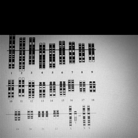 Solved Use The Following Karyotype To Identify Any Genetic