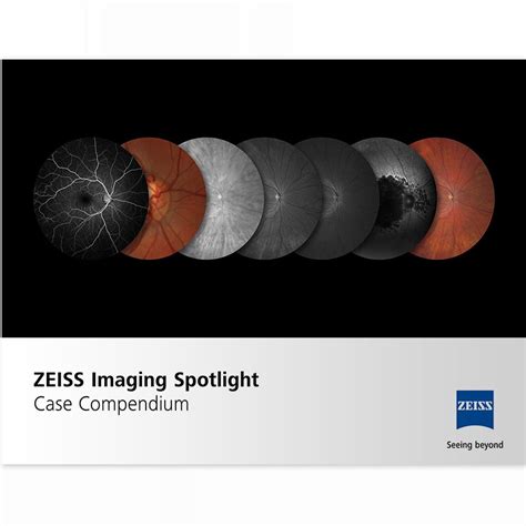 Zeiss Clarus 700 Zeiss Medical Technology