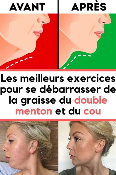 Comment R Duire Le Double Menton Naturellement R Duire Le Double