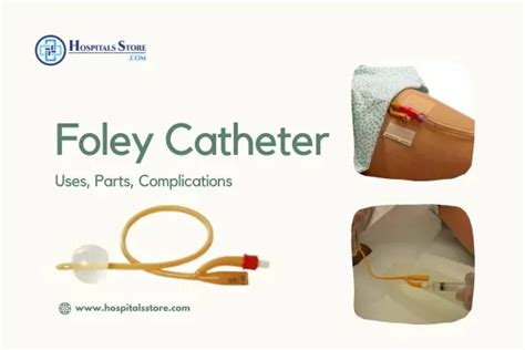 What is Foley Catheter: Uses, Parts, Complications